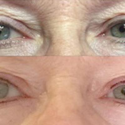 Yeux 6